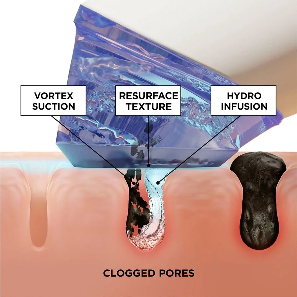 BeautyBio Pore Cleansing Tool - Picture 4 of 7